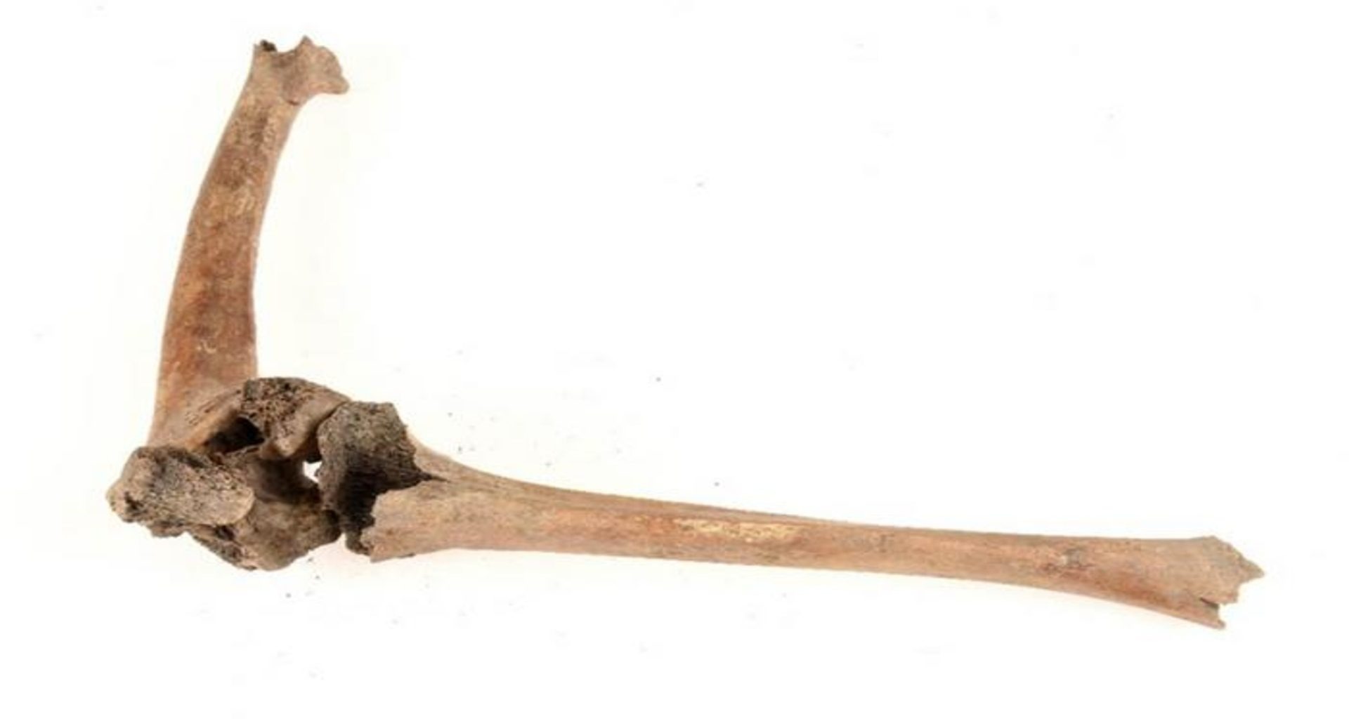 Novo estudo revela como os vikings cuidavam de pessoas com deficiência: pesquisa surpreende historiadores