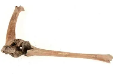 Novo estudo revela como os vikings cuidavam de pessoas com deficiência: pesquisa surpreende historiadores