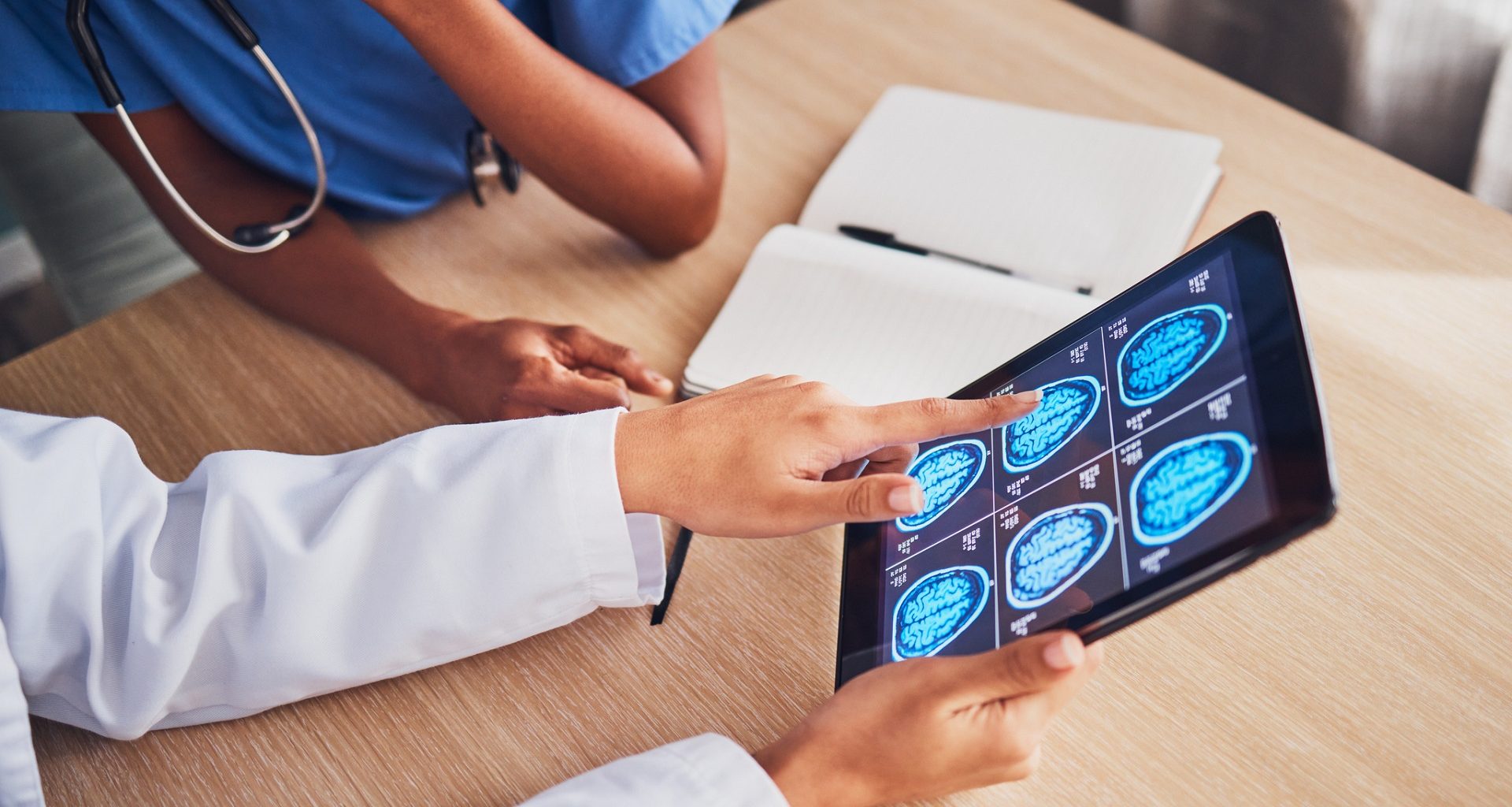 Novo teste de tumor cerebral traz diagnóstico em apenas duas horas! Revolução na medicina brasileira