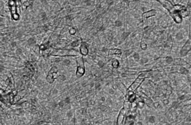 Minúsculas 'sementes' desenvolvem nanotubos de carbono que resfriam aparelhos pequenos