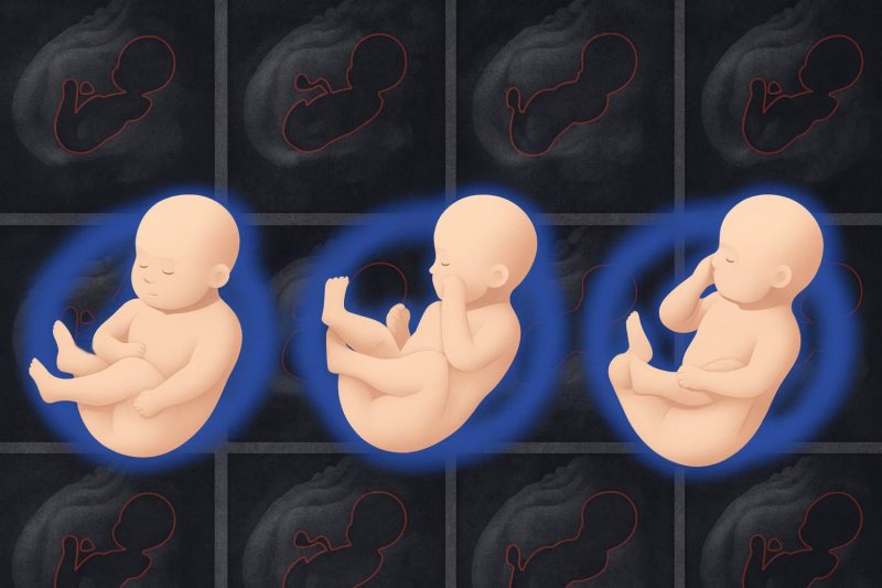Tecnologia de inteligência artificial traz imagens 3D mais detalhadas do bebê durante a gravidez